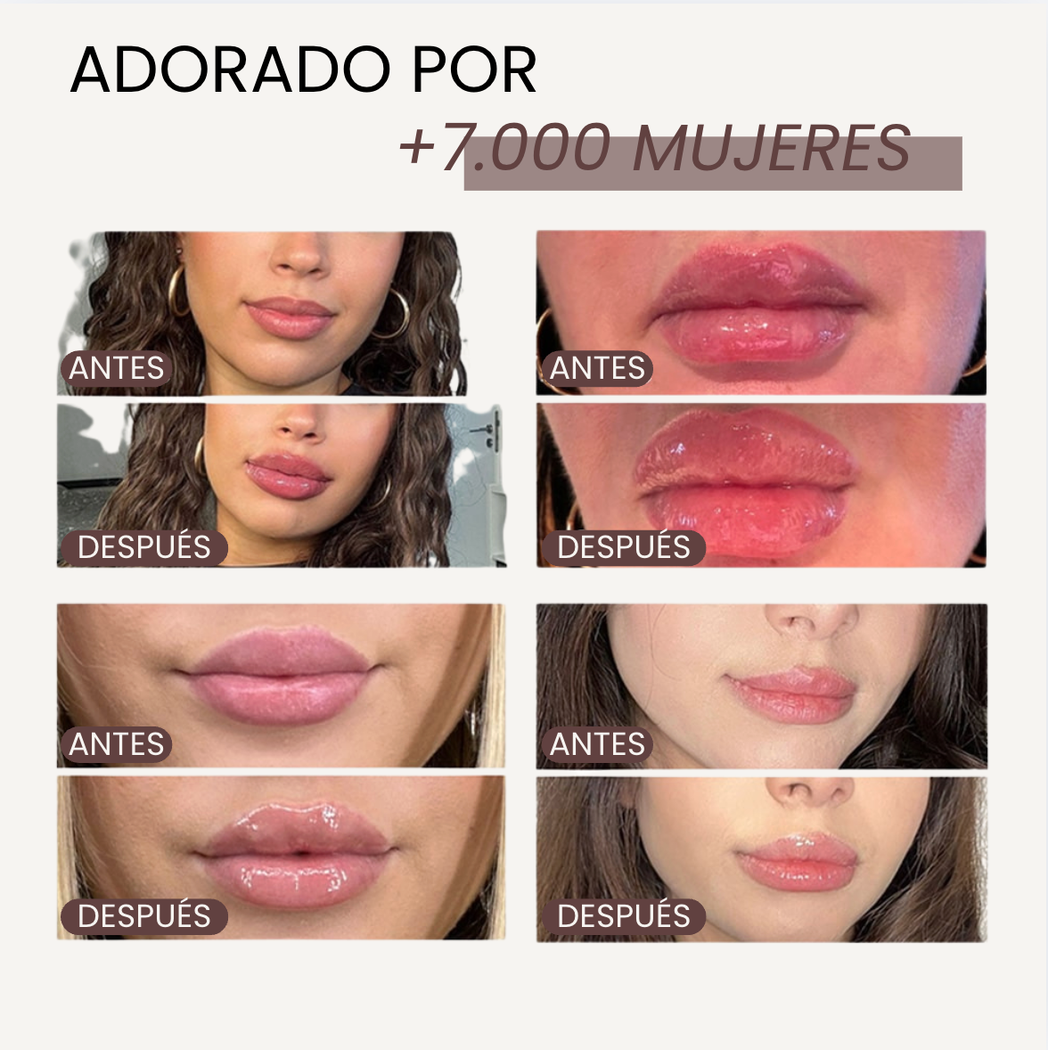 The Lip Lab - Lip Rise: Repulpador de labios