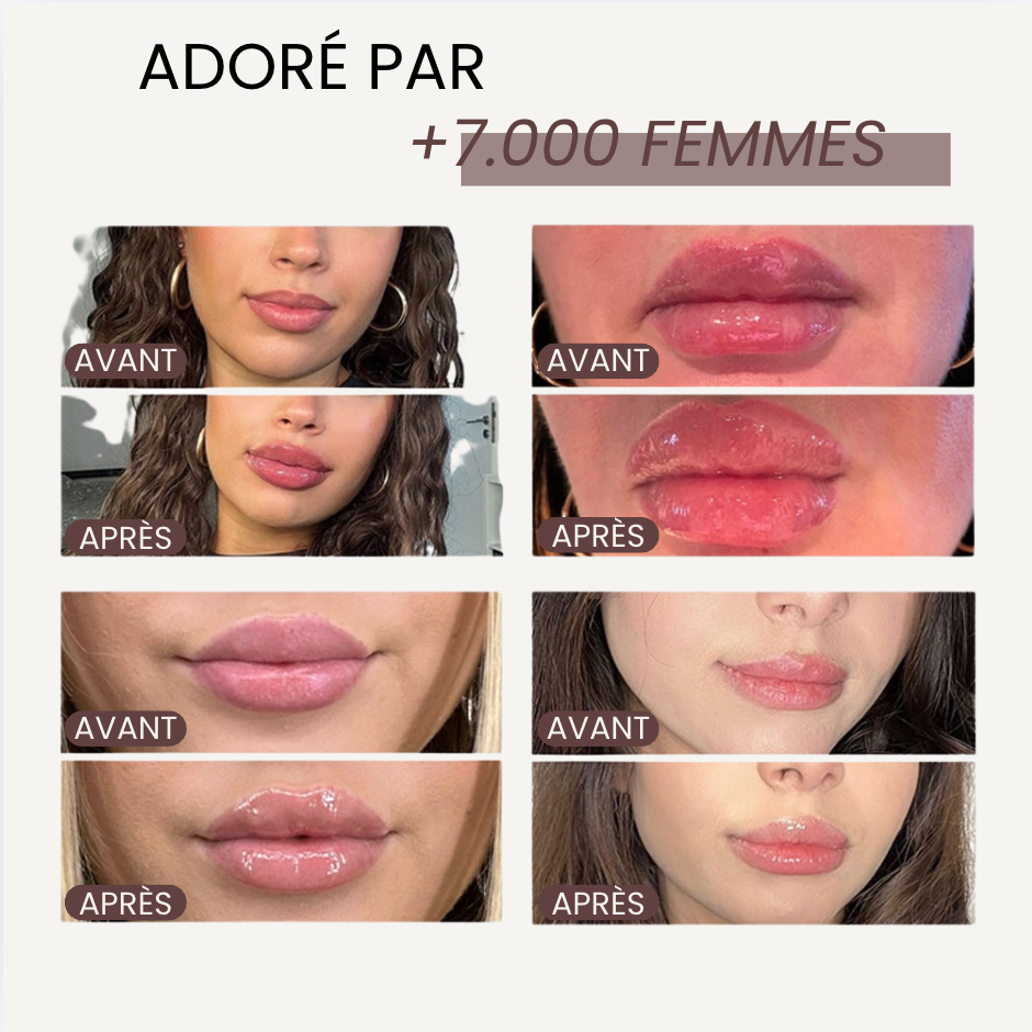 The Lip Lab - Repulpeur Extrême de lèvres