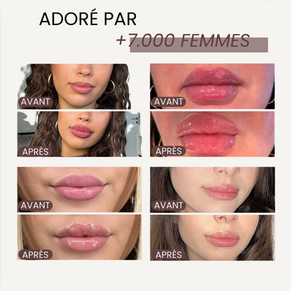 The Lip Lab - Repulpeur Extrême de lèvres