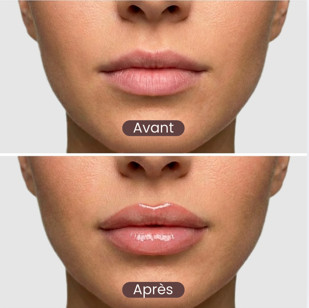 The Lip Lab - Lip Rise: Repulpeur de lèvres