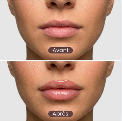 The Lip Lab - Lip Rise: Repulpeur de lèvres