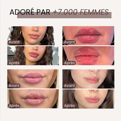 The Lip Lab - Lip Rise: Repulpeur de lèvres